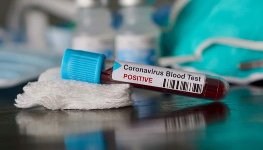 Coronavirus Pandemic: Tips to Stay Safe